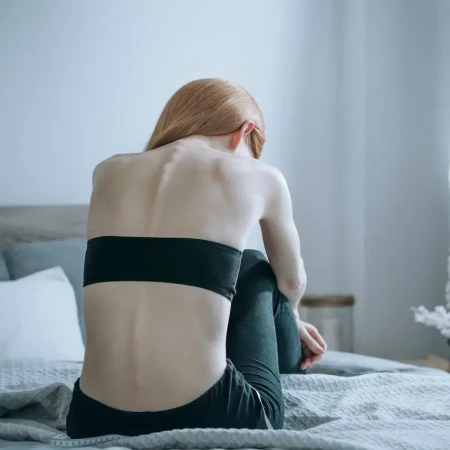 Anorexia e Bulimia
